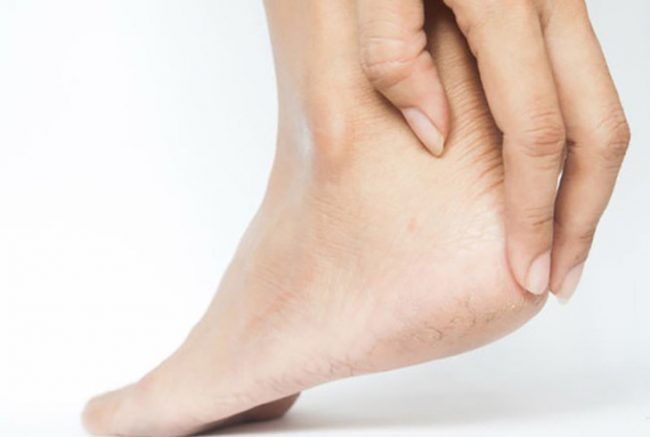 Gai gót chân điều trị thế nào